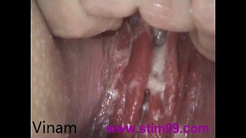 Bat Anal Fucking Gaping and Prolapse